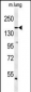 KDR (Y1175) Antibody